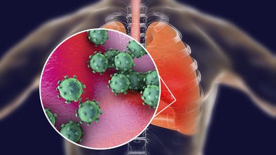 virus infecting human lungs