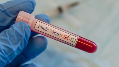 Ebola virus
