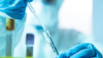 Covid-19 travel health test
