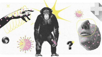 Monkeypox