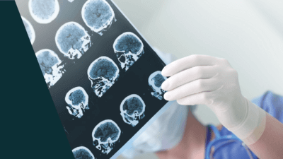 medical brain scans