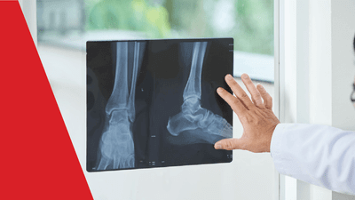 foot medical x-ray