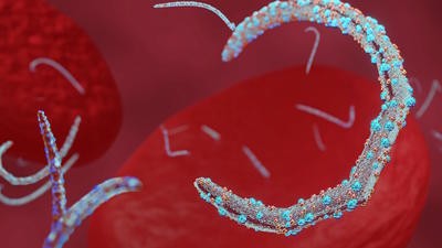 Marburg virus