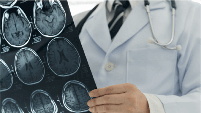 Doctor checking brain scans