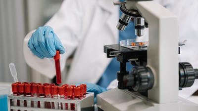 Medical testing ebola