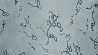 Ongoing Ebola outbreak in DRC highlights need for insurer preparedness