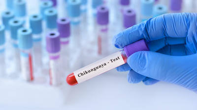 Costa Rica chikungunya outbreak travel health warning for tourists 