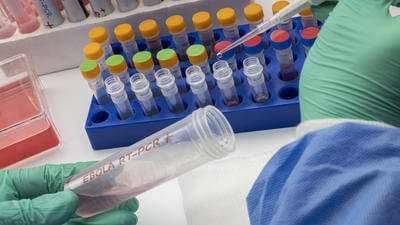 Ebola testing PCR