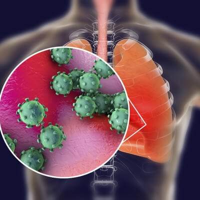 virus infecting human lungs