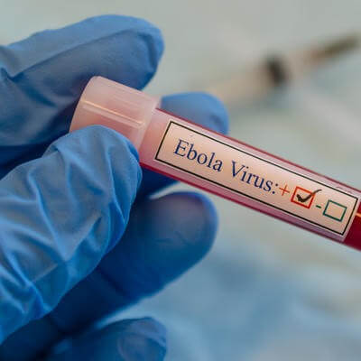 Ebola virus