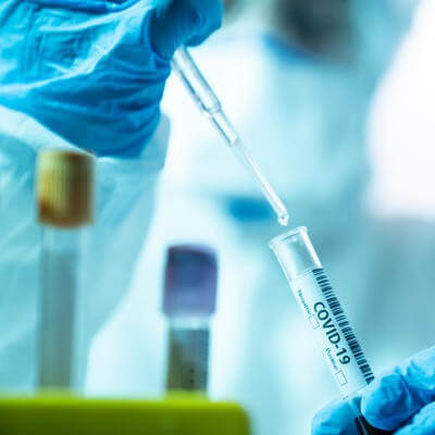 Covid-19 travel health test