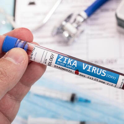 Zika virus