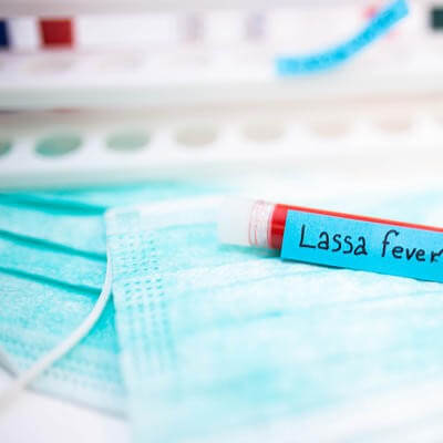 Lassa Fever