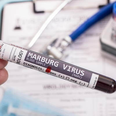 Marburg identified in Ghana