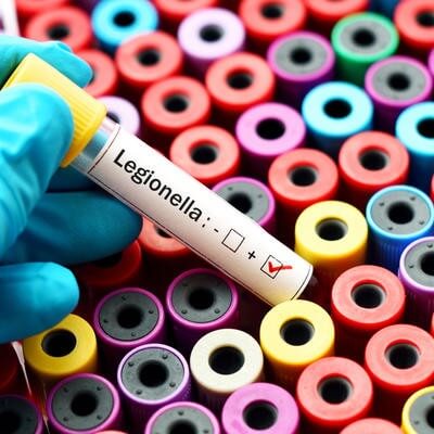 legionella
