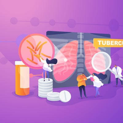 tuberculosis
