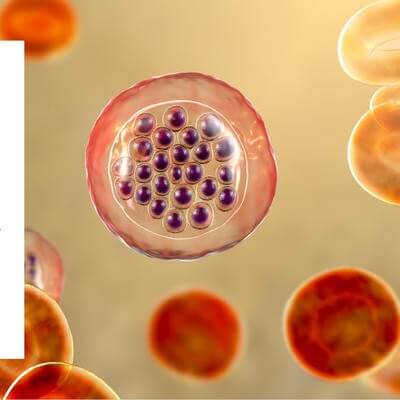 Graphic for an Interview with Dr Dipti Patel 