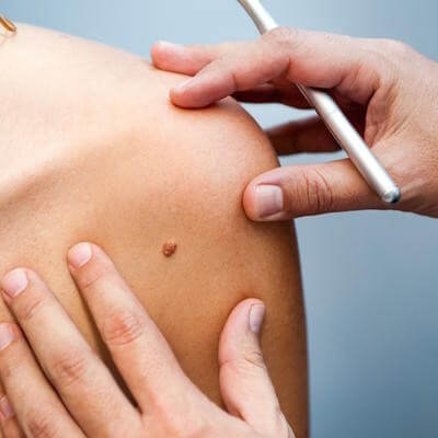 Healix dermatology GettyImages-524997413