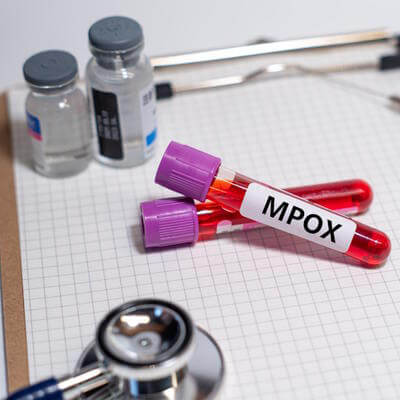 Mpox image