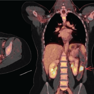 Bumrungrad International Hospital