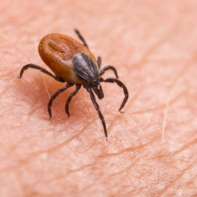 Tick-borne-encephalitis case in Europe 