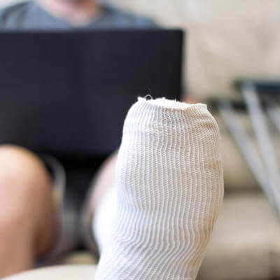 A man sits on a sofa in a cast with a laptop. A leg in a cast lies on a chair