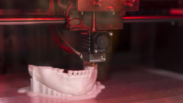 3d printer teeth