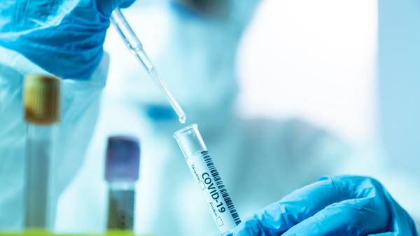 Covid-19 travel health test