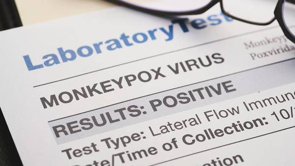 Monkeypox positive test results