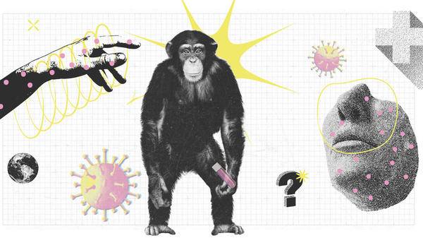 Monkeypox