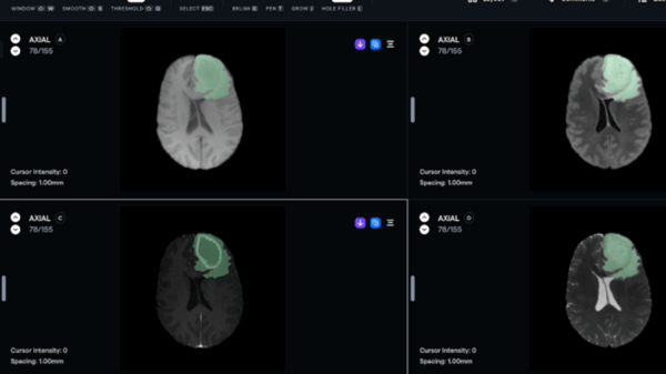 Redbrick AI