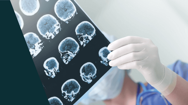 medical brain scans