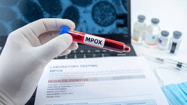 Germany identifies first mpox clade 1b case | ITIJ