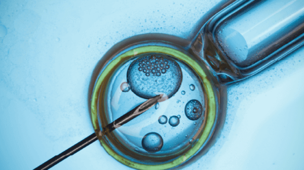 IVF treatment