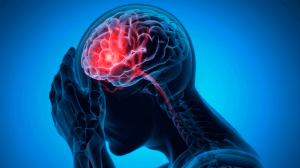 An illustration of person with head pain