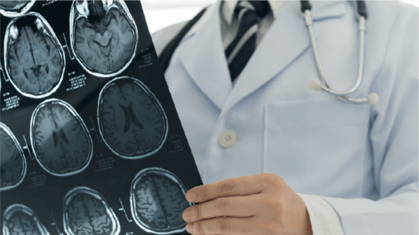 Doctor checking brain scans