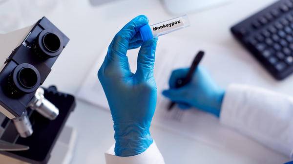 A new case of the mpox variant clade 1b has been identified in England ...