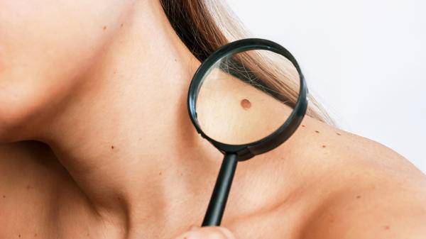 Bupa expands at-home skin assessment service to wider conditions