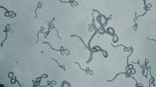 Ebola patient medically evacuated from Nigeria to Switzerland 