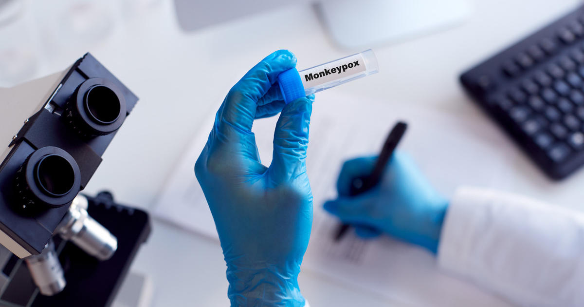 A new case of the mpox variant clade 1b has been identified in England ...